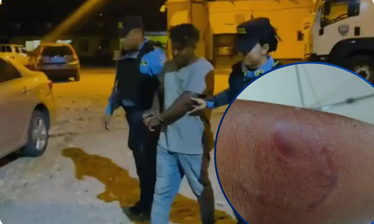 Misquito detenido por violencia doméstica: permanece preso tras agredir y morder a un policía