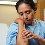 Picazón persistente sin sarpullido: el hígado puede estar detrás